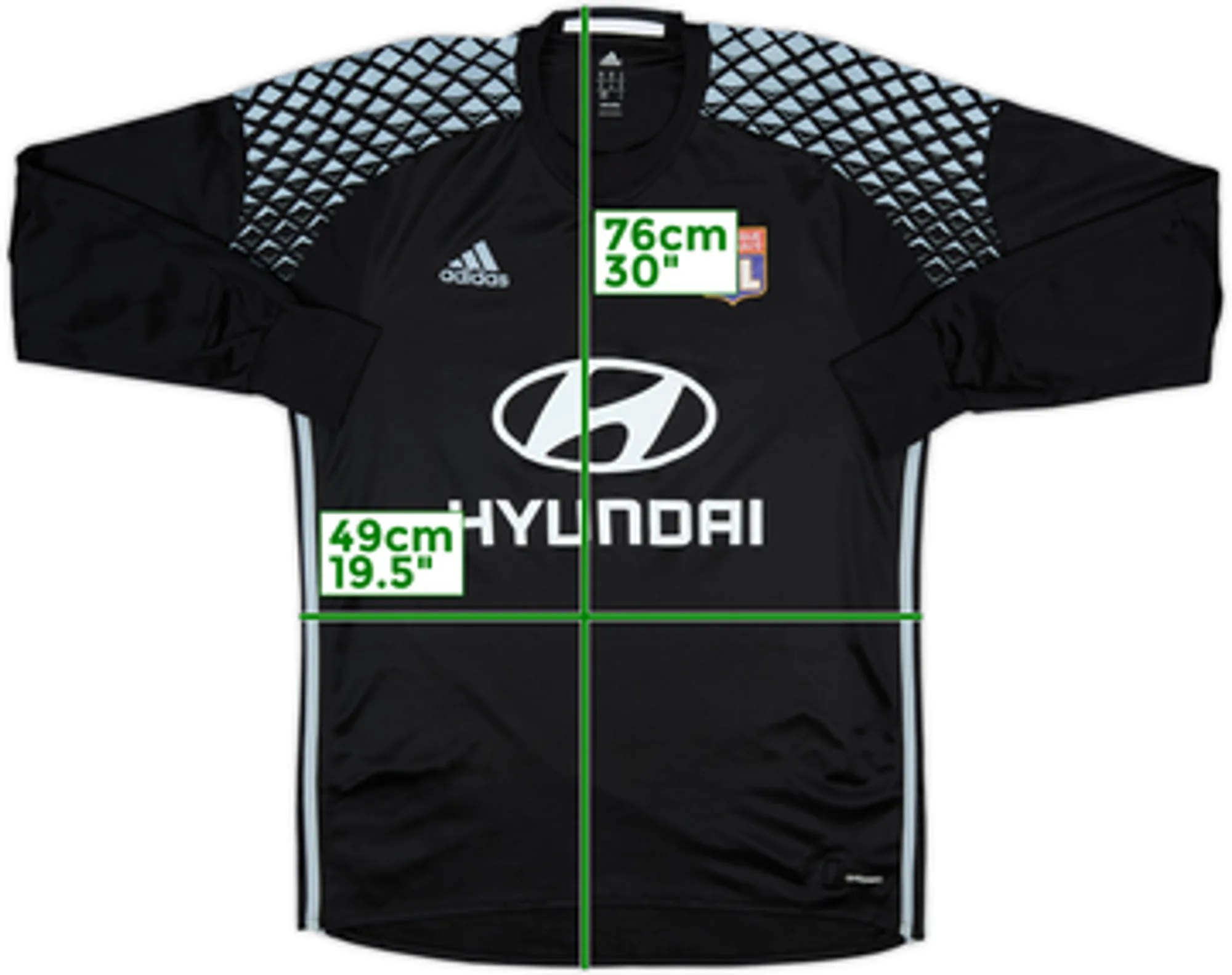 2016-17 Lyon GK Shirt - 8/10 - (M)