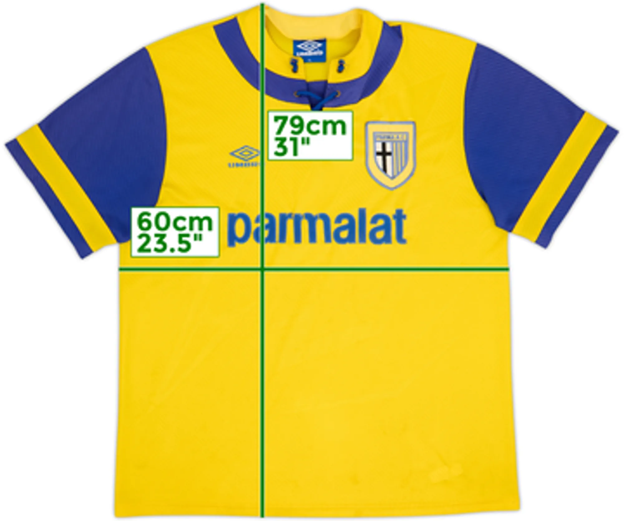 1993-95 Parma Away Shirt - 6/10 - (XL)