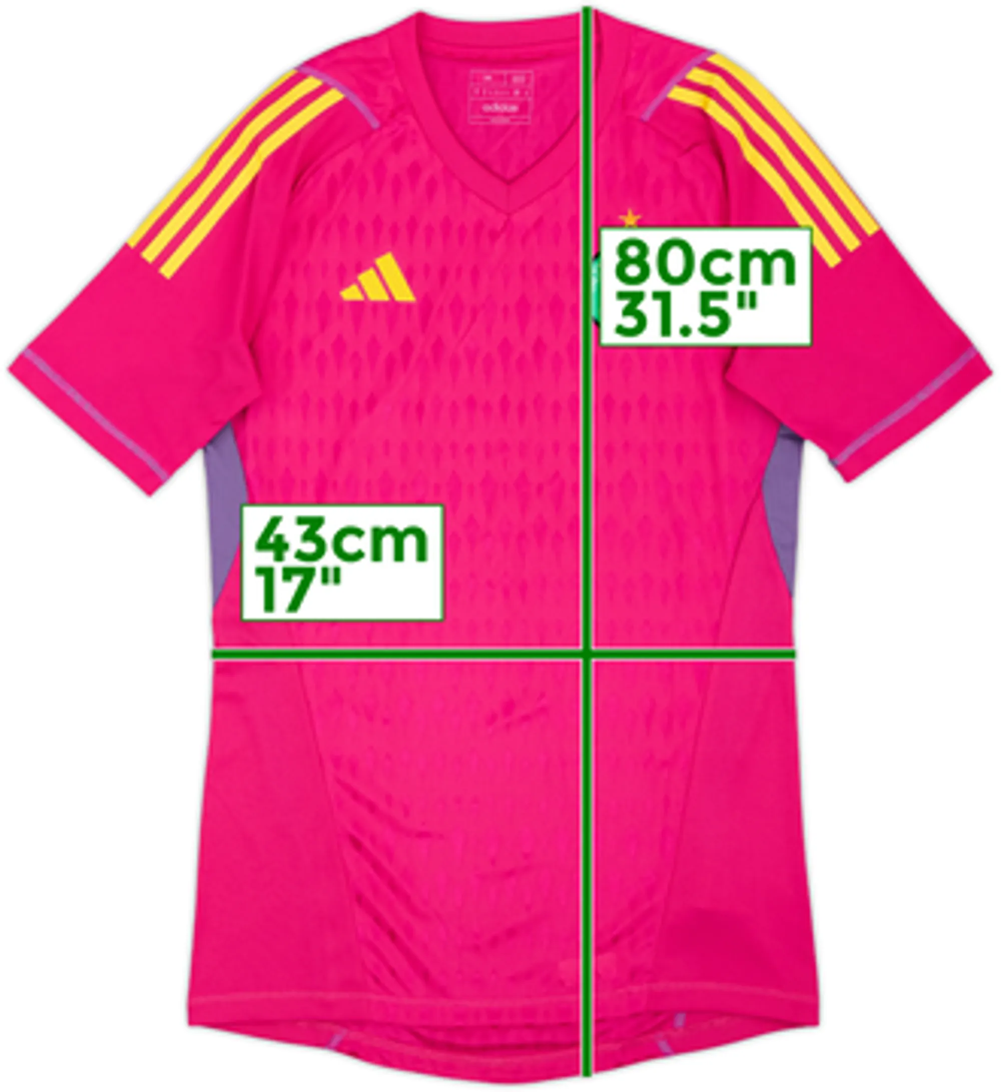 2023-24 Celtic GK S/S Shirt - 8/10 - (M)